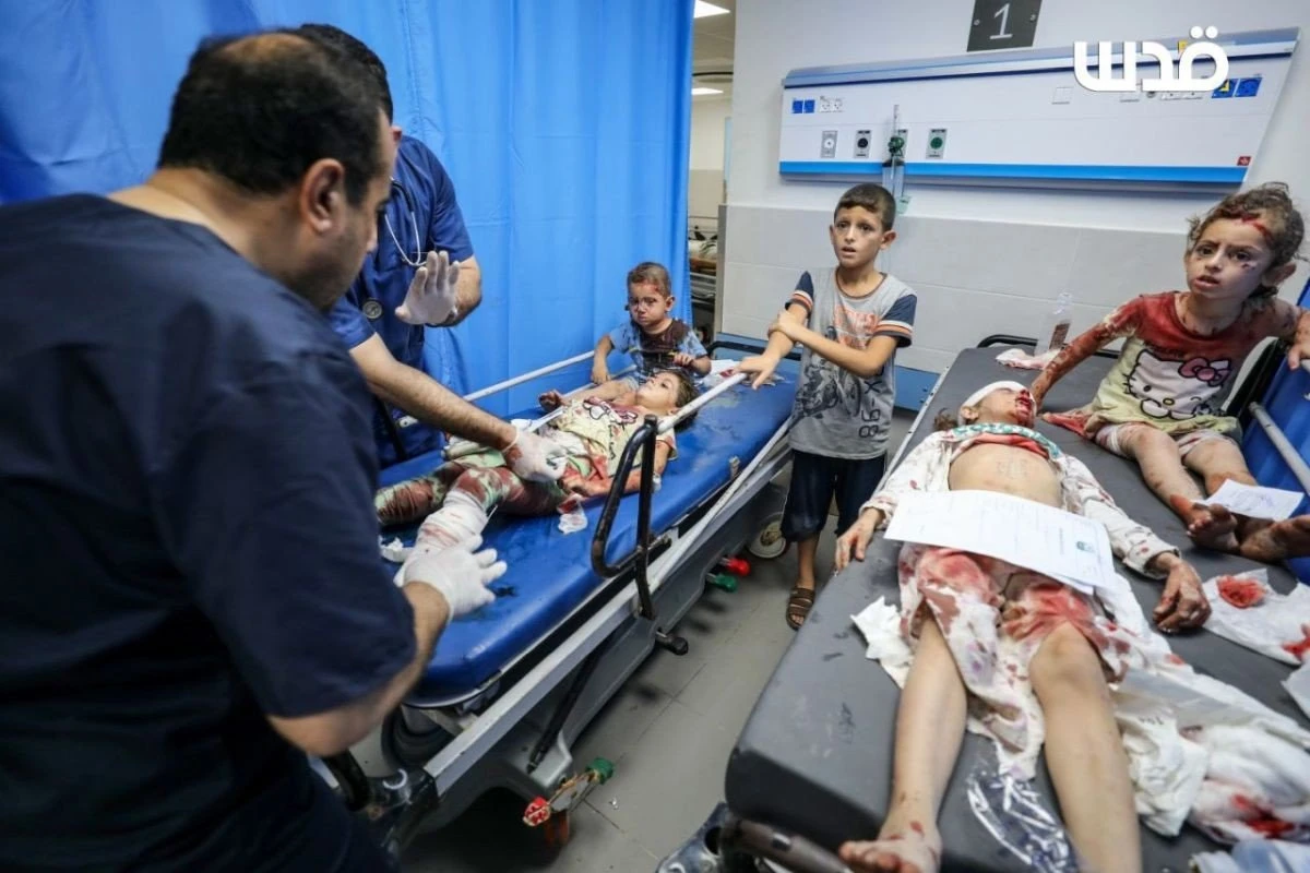 Τραυματισμένα παιδιά στη Γάζα. Πηγή: https://twitter.com/Timesofgaza/status/1711462801246433574/photo/2