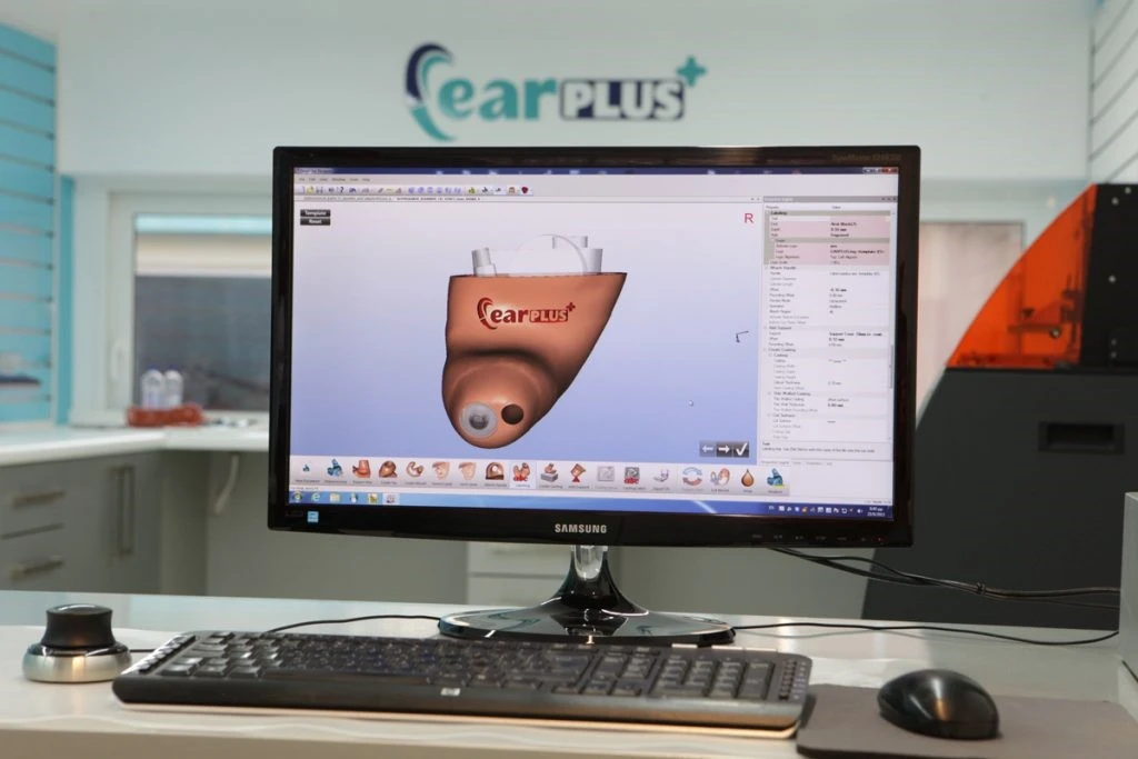 earplus-deteoghloy9.jpg