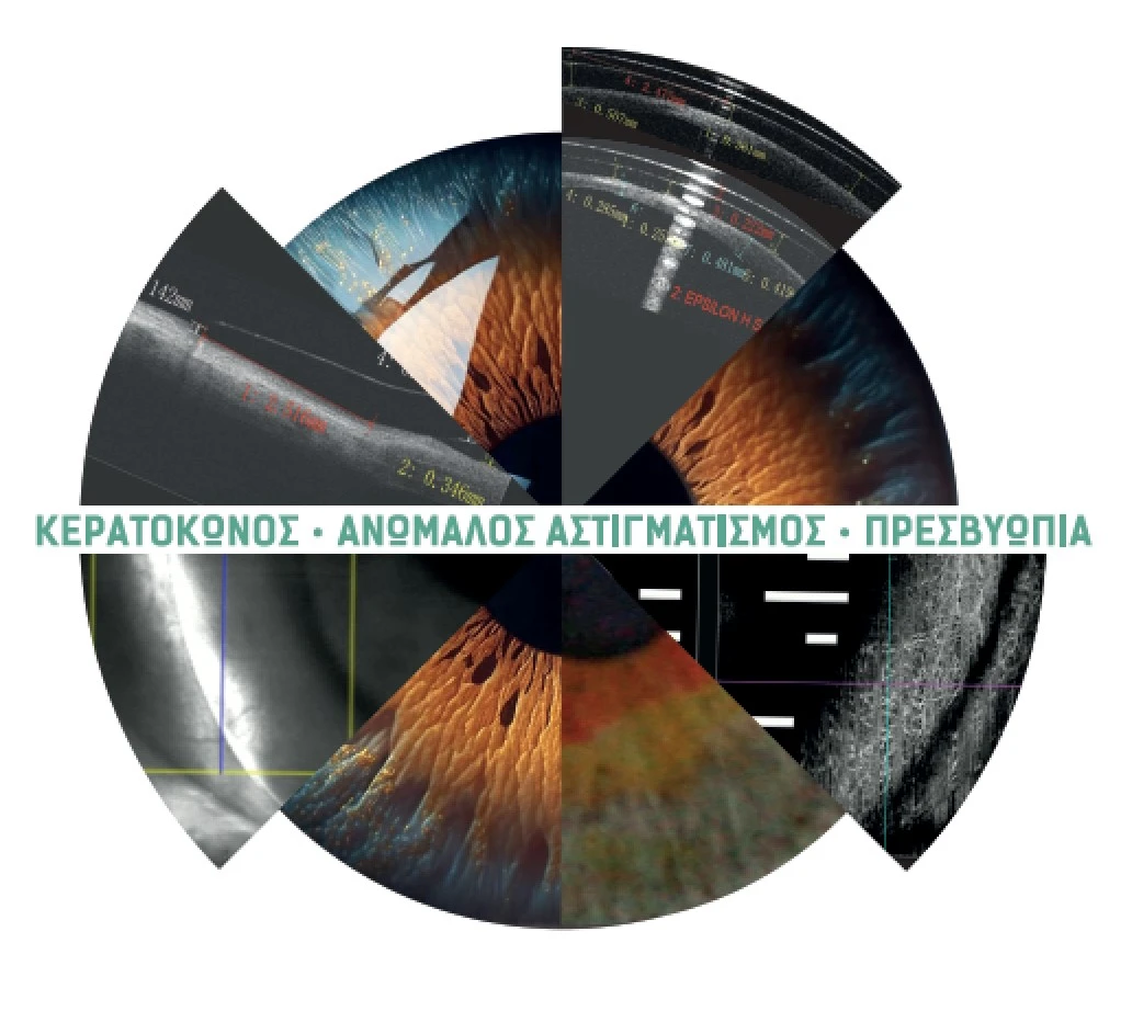 eyeart8.jpg