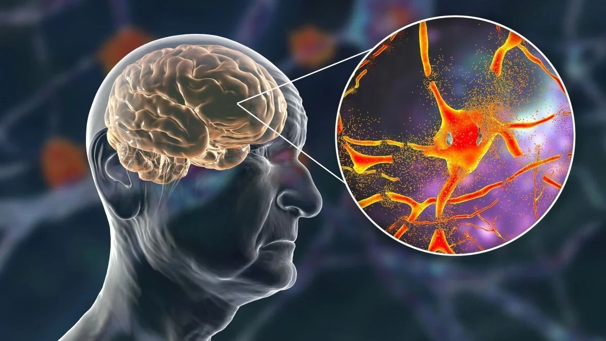 alzheimer.jpg?v=0