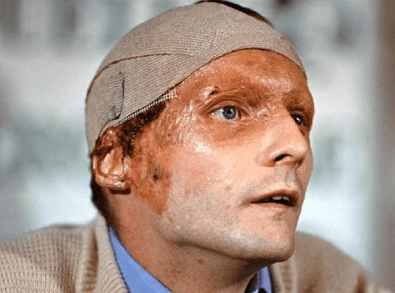 &nbsp;Ο Νίκι Λάουντα μετά το ατύχημα