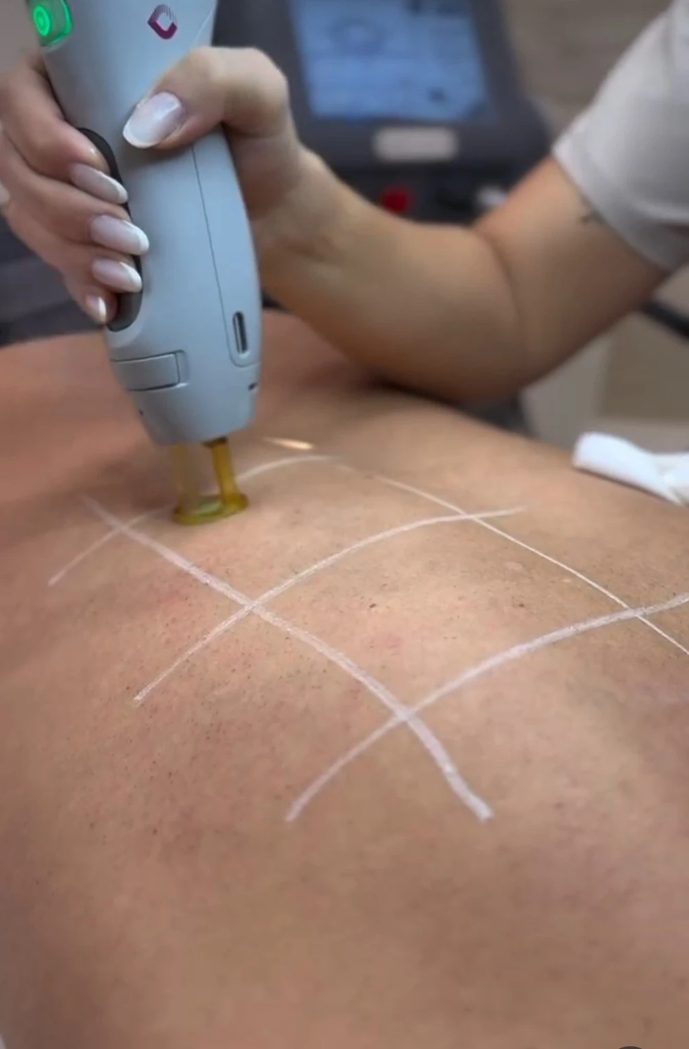 aeras-beauty-6.jpg?v=0