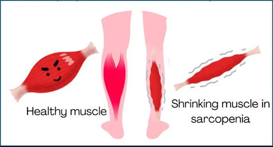 diet-tips-2.jpg?v=0