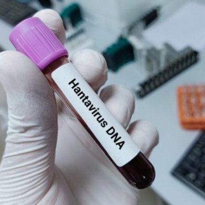 Σε επιφυλακή η Γαλλία για τον χανταϊό: Εντολή Μακρόν για αυστηρή παρακολούθηση
