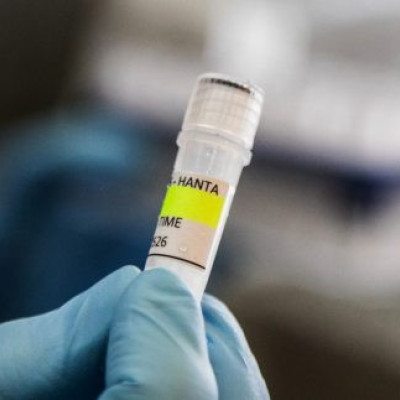 Ιταλία: Το υπουργείο υγείας ενεργοποίησε διαδικασία επιτήρησης για τέσσερις επιβάτες πτήσης που ήρθαν σε επαφή με γυναίκα που πέθανε από Χανταϊό