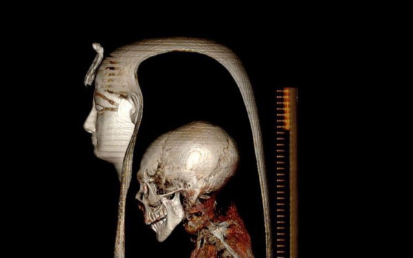 Αιγύπτιοι ερευνητές «διείσδυσαν» στη μούμια του φαραώ Αμενχοτέπ Α' (φωτ.)