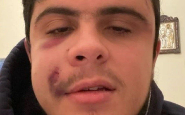 Νέα καταγγελία οπαδικής βίας - «Αυτό που χωρίζει εμένα από τον Άλκη είναι η τύχη» (βίντεο)