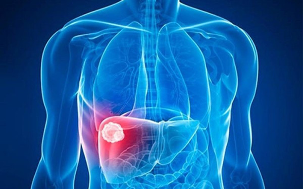 Νέο «έξυπνο» τεστ αίματος ανιχνεύει τον καρκίνο του ήπατος