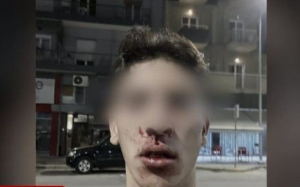 Βίντεο ντοκουμέντο από τον ξυλοδαρμό 20χρονου στα Λαδάδικα