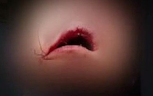 Λουτράκι: Σοκάρουν οι εικόνες από τον ξυλοδαρμό 16χρονου στο ΕΠΑΛ - 15χρονος του έσπασε τη γνάθο (βίντεο)