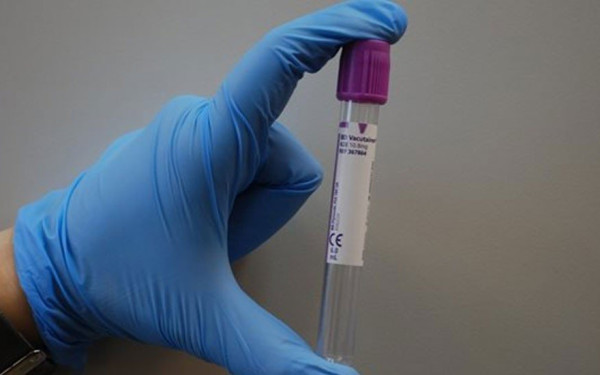 Σημαντική ανακάλυψη: Ανέπτυξαν γρήγορο και φθηνό τεστ ανίχνευσης καρκίνου του προστάτη