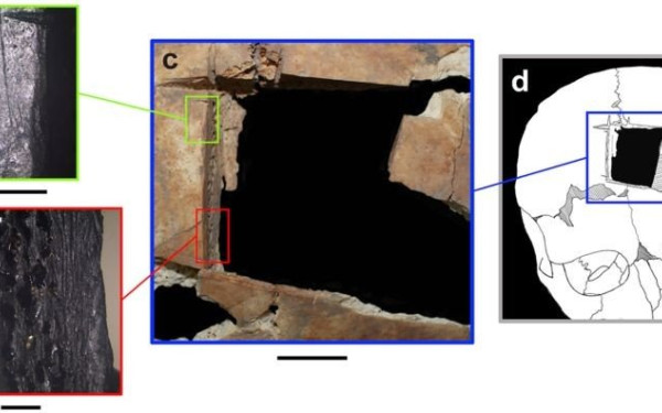 Εντυπωσιακή ανακάλυψη στο Ισραήλ: Βρέθηκε κρανίο με τετράγωνη τρύπα - Ένδειξη για χειρουργική εγκεφάλου πριν 3.500 χρόνια