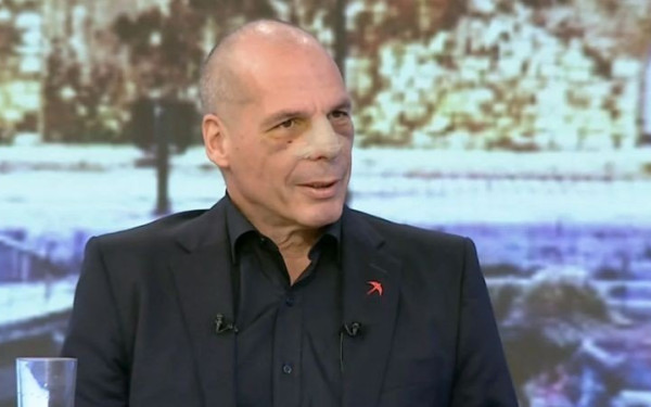 Βαρουφάκης: Η πρώτη εμφάνιση μετά την επίθεση στα Εξάρχεια - Τα εμφανή σημάδια στο πρόσωπο (βίντεο)