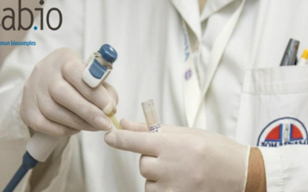 Μetabio: Η start up της Θεσσαλονίκης, που στηρίζει την φαρμακευτική έρευνα