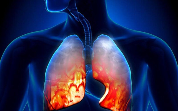 Έλληνες ερευνητές λύνουν τον γρίφο των σοβαρών λοιμώξεων του αναπνευστικού