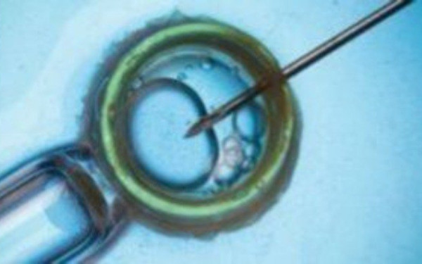 Η υπογονιμότητα μπορεί να οδηγήσει σε πιο σοβαρά συμπτώματα εμμηνόπαυσης