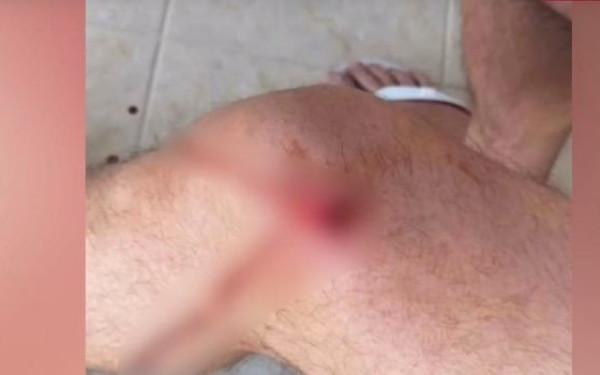 Άνω Λιόσια: Βγήκε στο μπαλκόνι να πιει καφέ και παραλίγο να σκοτωθεί από αδέσποτη σφαίρα (βίντεο)