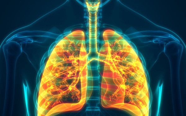 Μελέτη-ΑΠΘ: Έδειξε ότι το μονοκλωνικό αντίσωμα μεπολιζουμάμπη συσχετίζεται με βελτίωση της λειτουργίας των πνευμόνων