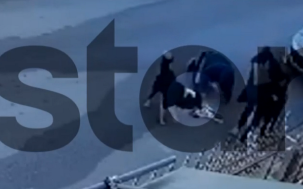 Η στιγμή της επίθεσης σκύλου σε 9χρονο στο Καματερό (βίντεο)