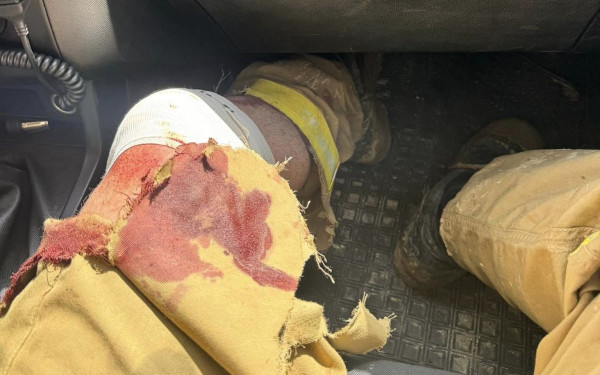 Τραυματίστηκε εθελοντής πυροσβέστης την ώρα της μάχης με την πυρκαγιά στα Πιέρια Όρη (βίντεο, φωτ.)