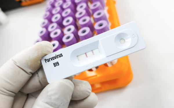 Τα συμπτώματα του παρβοϊού που χτυπούν καμπανάκι