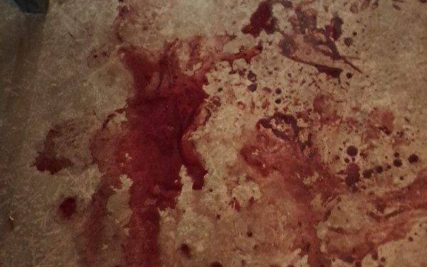 Χαλκιδική: Σφραγίζεται οριστικά το beach bar που σημειώθηκε το αιματηρό περιστατικό