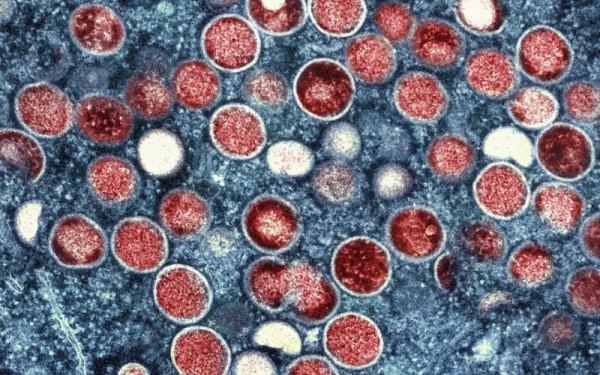 ECDC: Ποιοι κινδυνεύουν περισσότερο από την ευλογιά των πιθήκων στην Ευρώπη