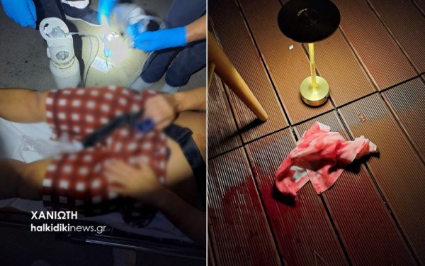 Χαλκιδική: Πώς συνέβη η αιματηρή συμπλοκή με τους τρεις τραυματίες σε beach bar στη Χανιώτη - Πέντε συλλήψεις (βίντεο)