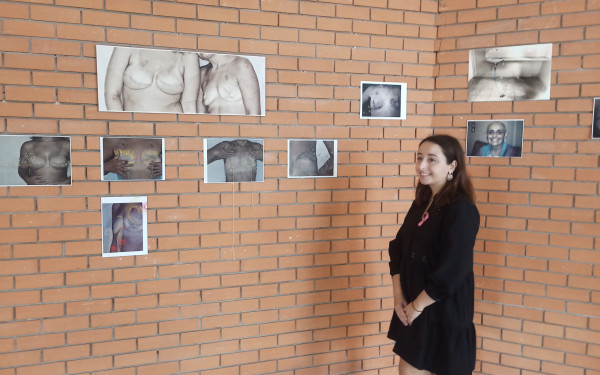 Θεσσαλονίκη: Η «ομορφιά του τραύματος» - Όταν ο καρκίνος του μαστού μετατρέπεται σε τέχνη δίνοντας μήνυμα ελπίδας