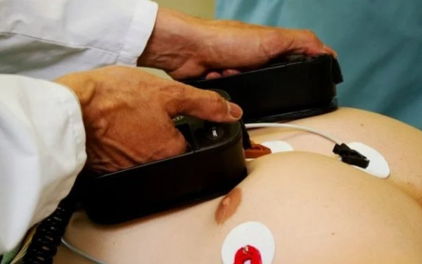 Χαλκιδική: Γιατρός έσωσε 53χρονο Άγγλο τουρίστα μετά από διπλή καρδιακή ανακοπή σε ξενοδοχείο
