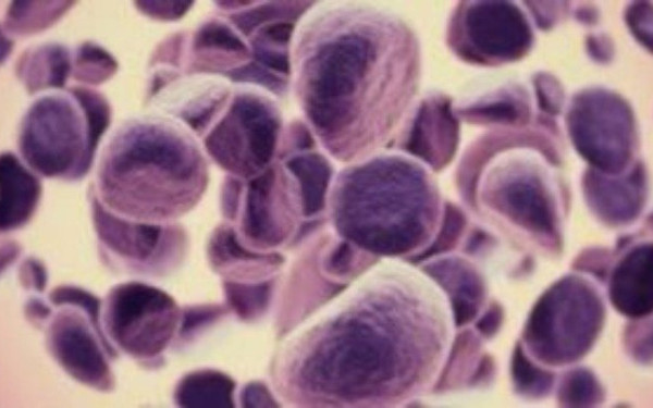 Καινοτόμος μέθοδος για απεικόνιση, διάγνωση και θεραπεία του καρκίνου με σφραγίδα Έλληνα καθηγητή