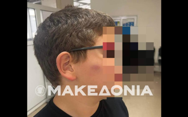 Θεσσαλονίκη: Ανήλικοι ξυλοκόπησαν 11χρονο μαθητή στο προαύλιο Δημοτικού Σχολείου