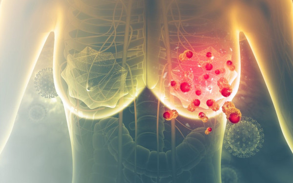 Μαστογραφία με Τεχνητή Νοημοσύνη: Η νέα εποχή στην πρόληψη του καρκίνου του μαστού