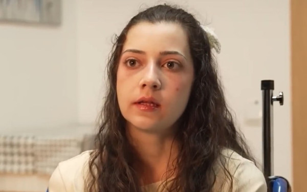 Ισπανία: 25χρονη τετραπληγική υποβλήθηκε σε ευθανασία, παρά τις αντιρρήσεις της οικογένειάς της (βίντεο)