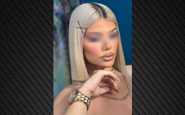 Κεφαλονιά: Οι αρχές δεν βλέπουν έγκλημα πίσω από τον θάνατο της 19χρονης