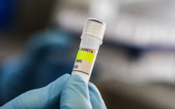 Ιταλία: Το υπουργείο υγείας ενεργοποίησε διαδικασία επιτήρησης για τέσσερις επιβάτες πτήσης που ήρθαν σε επαφή με γυναίκα που πέθανε από Χανταϊό