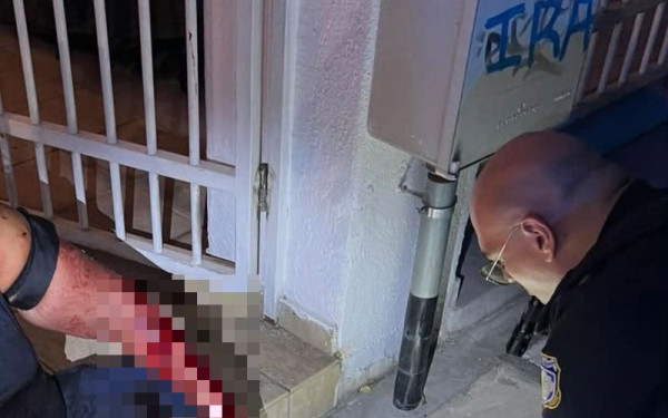 Θεσσαλονίκη: 31χρονος φέρεται να τραυμάτισε με μαχαίρι 25χρονη - Της έβαλαν τουρνικέ οι αστυνομικοί