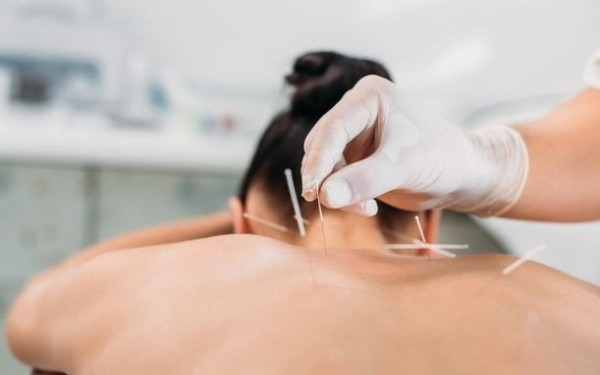 Ο βελονισμός περιορίζει το εγκεφαλικό που σχετίζεται με ρευματοειδή αρθρίτιδα