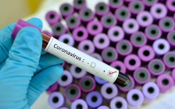 Κορονοϊός: Σχεδόν 1.700 κρούσματα στην Ιταλία, 34 οι νεκροί