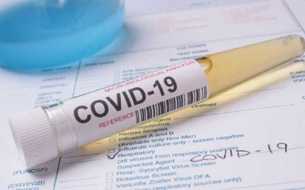 ΗΠΑ: Μήνυση κατά της CIA - Κατηγορίες ότι αρνήθηκε να παραδώσει έγγραφα για την προέλευση του Covid-19