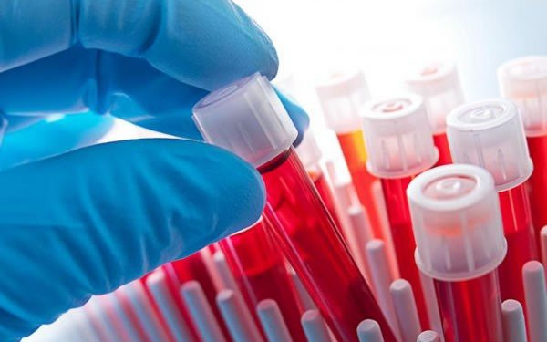 Θεσσαλονίκη: Ποια είναι τα 25 Κέντρα Υγείας που θα πραγματοποιούνται χωρίς ραντεβού οι αιματολογικές εξετάσεις