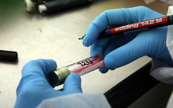 Κορονοϊός: Αυξάνονται τα κρούσματα στους άνω των 65