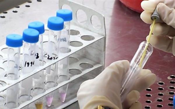 Κατάργηση του claw back ζητούν οι Φορείς Πρωτοβάθμιας Φροντίδας Υγείας