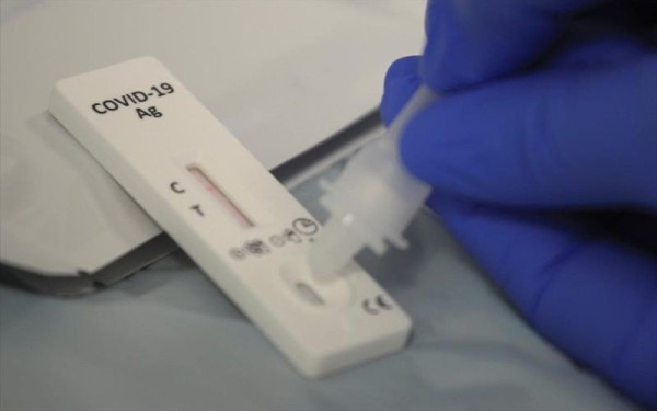 Σκέρτσος για self tests: Χωρίς αμοιβή η διάθεσή τους από τα φαρμακεία