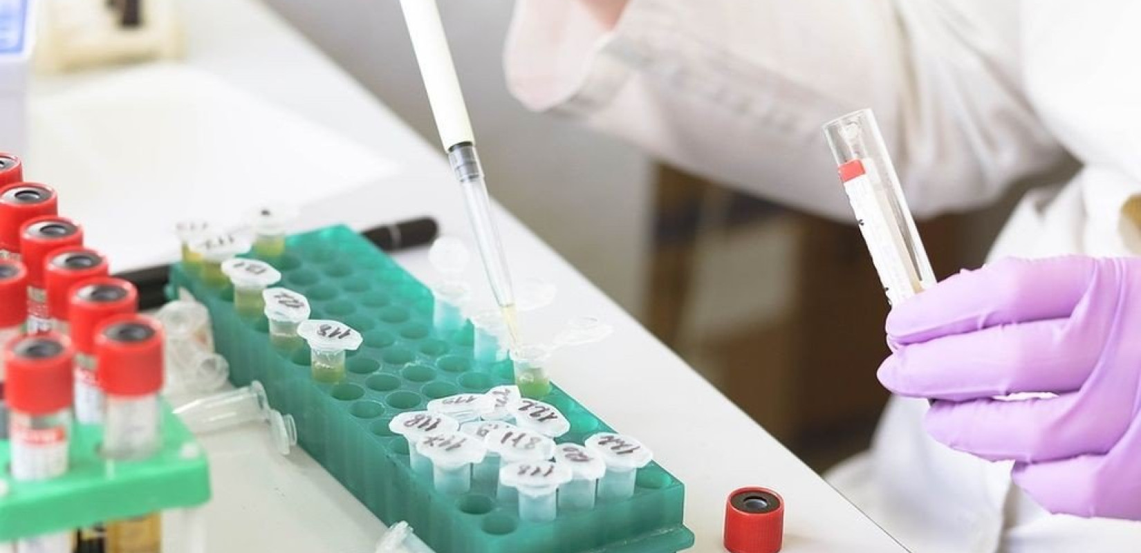 Τα αντιβιοτικά χάνουν επικίνδυνα την αποτελεσματικότητά τους - Τι λύσεις ψάχνει η επιστήμη