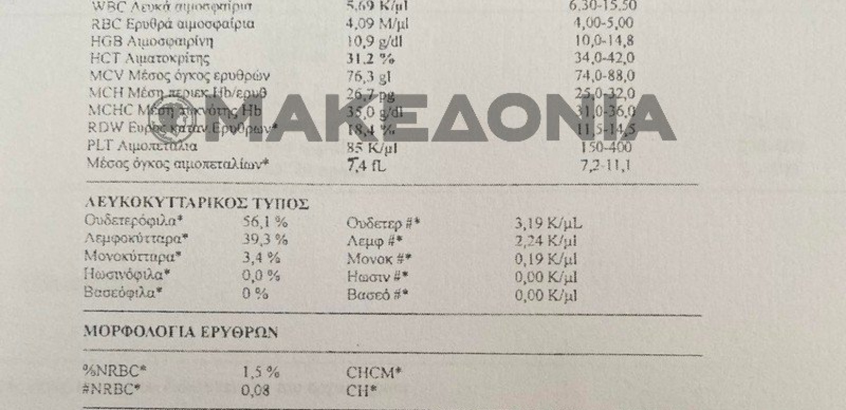 Θάνατος 3χρονης: Τα πρώτα στοιχεία από τον ιατρικό φάκελο - Οι εξετάσεις από το Ιπποκράτειο που θα δώσουν απαντήσεις