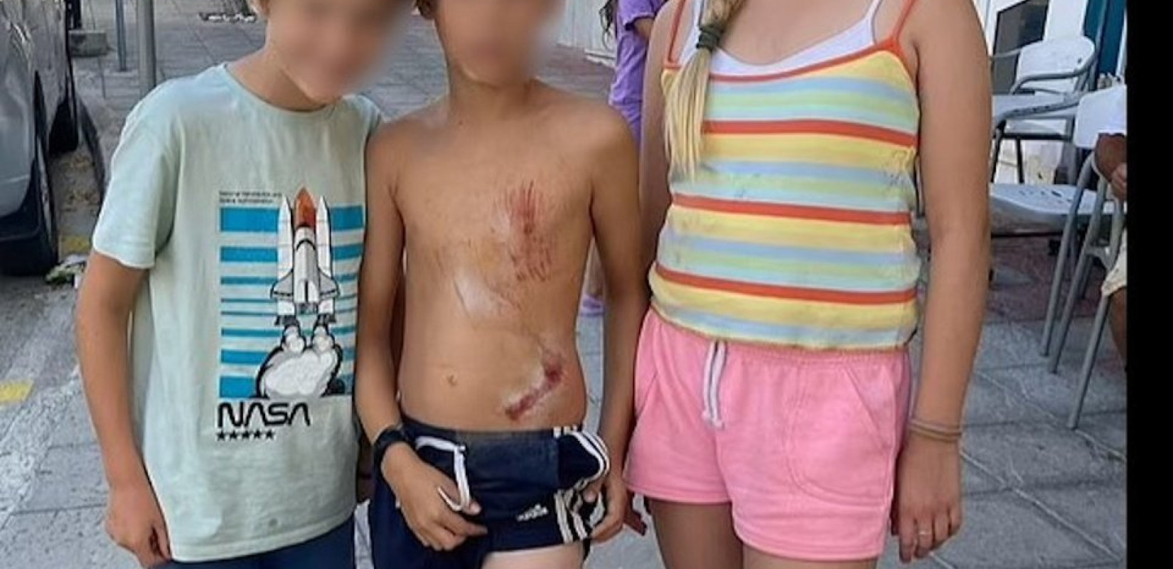 Άγρια επίθεση αγέλης 15 σκύλων εναντίον οικογένειας στο ηφαίστειο Σουσάκι στην Κόρινθο