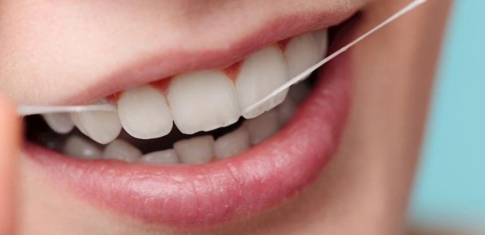 Έρευνα δείχνει πως η  ουλίτιδα συνδέεται με αυξημένο κίνδυνο σοβαρών καρδιαγγειακών επεισοδίων