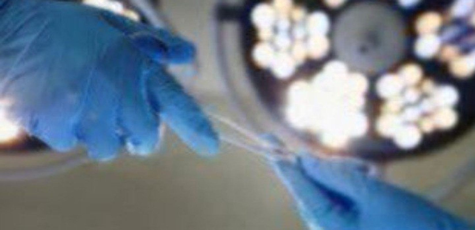 Τεχνητό πάγκρεας δοκιμάστηκε με επιτυχία σε ασθενείς με διαβήτη τύπου 2