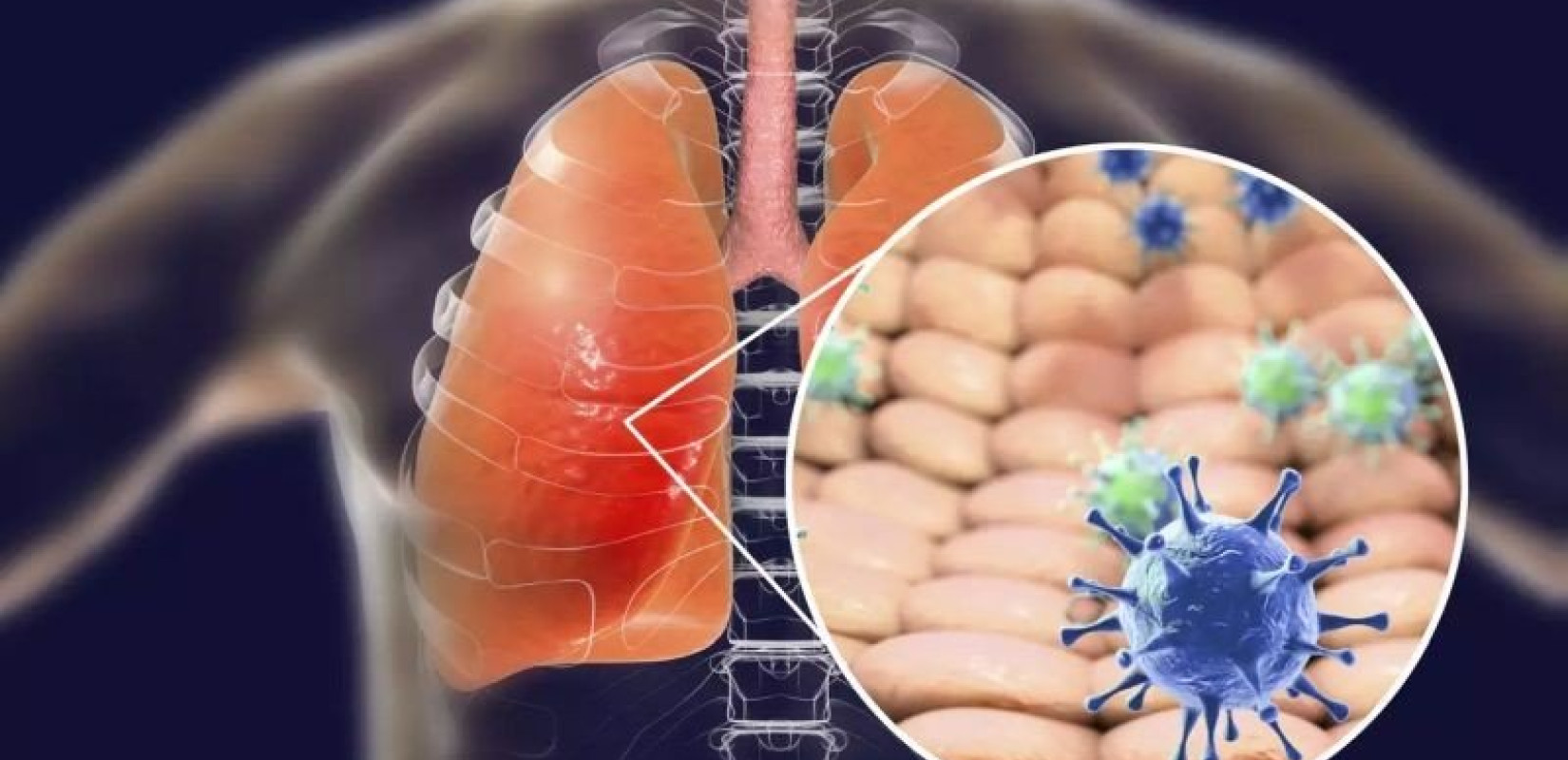 Δήμος Θεσσαλονίκης: Πρόγραμμα άσκησης για άτομα με Χρόνια Αποφρακτική Πνευμονοπάθεια